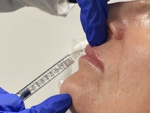 New injectables licensing - London Real Skin