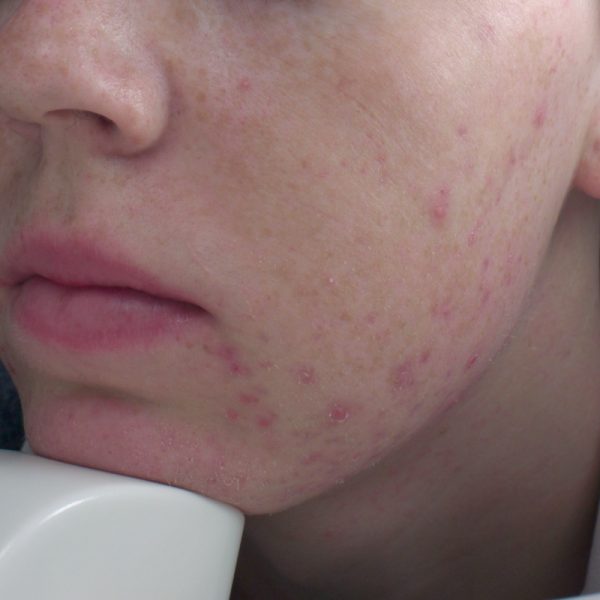 Forer, Preben 20190117 Spots Before crop Forer, Preben 20190117 Spots Before crop