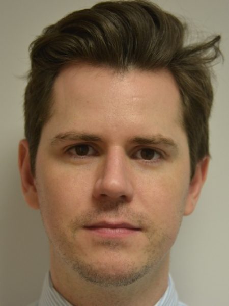 Male Jaw Enhacement – Before 43 Male Jaw Enhacement - Before 43