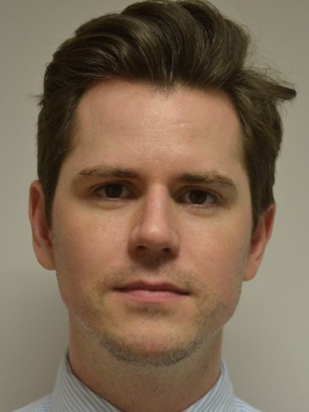 Male Jaw Enhancement – After 43 Male Jaw Enhancement - After 43
