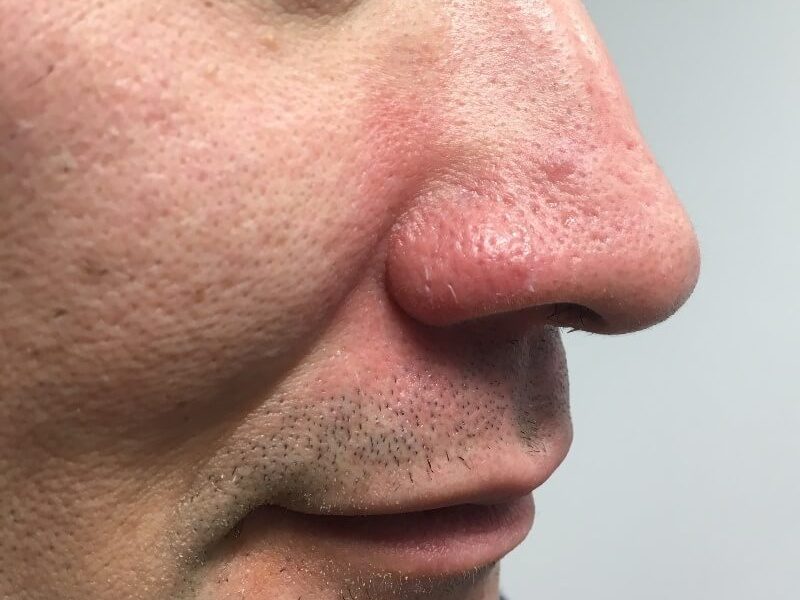 Thread Veins 02 – After sq 86 Thread Veins 02 - After sq 86